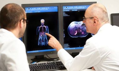 Urgent action from Ministry of  health to combat and treat tumors